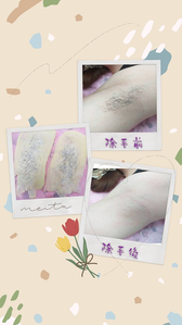 熱臘除毛~腋下~特價850元