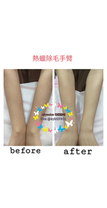 熱臘除毛~前手臂~特價1000元