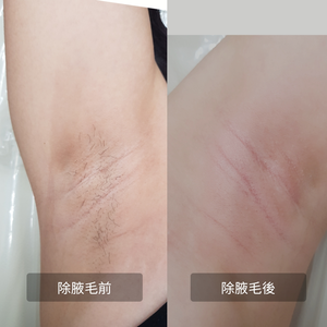 熱臘除毛~背部~特價1600元